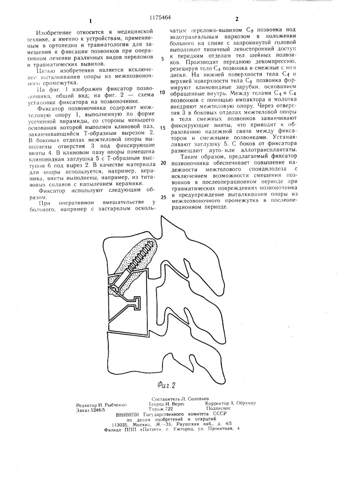 Фиксатор позвоночника (патент 1175464)