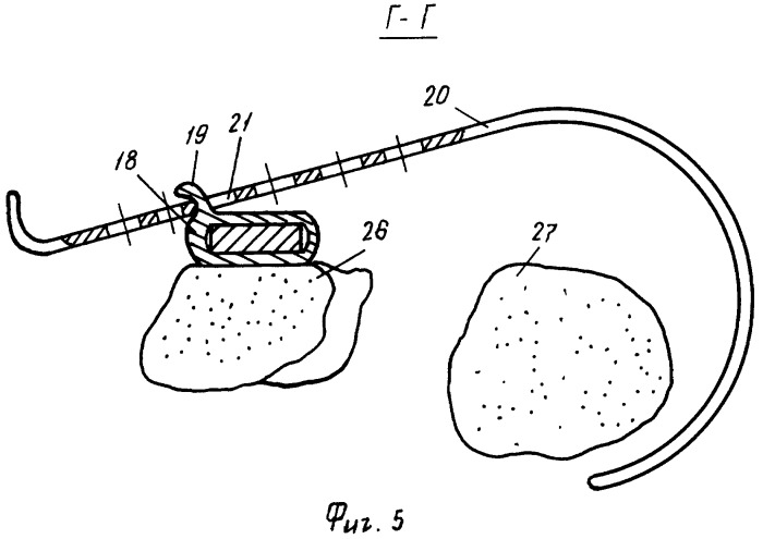 Устройство регулируемое для хирургических вмешательств в органы брюшной полости (патент 2391054)