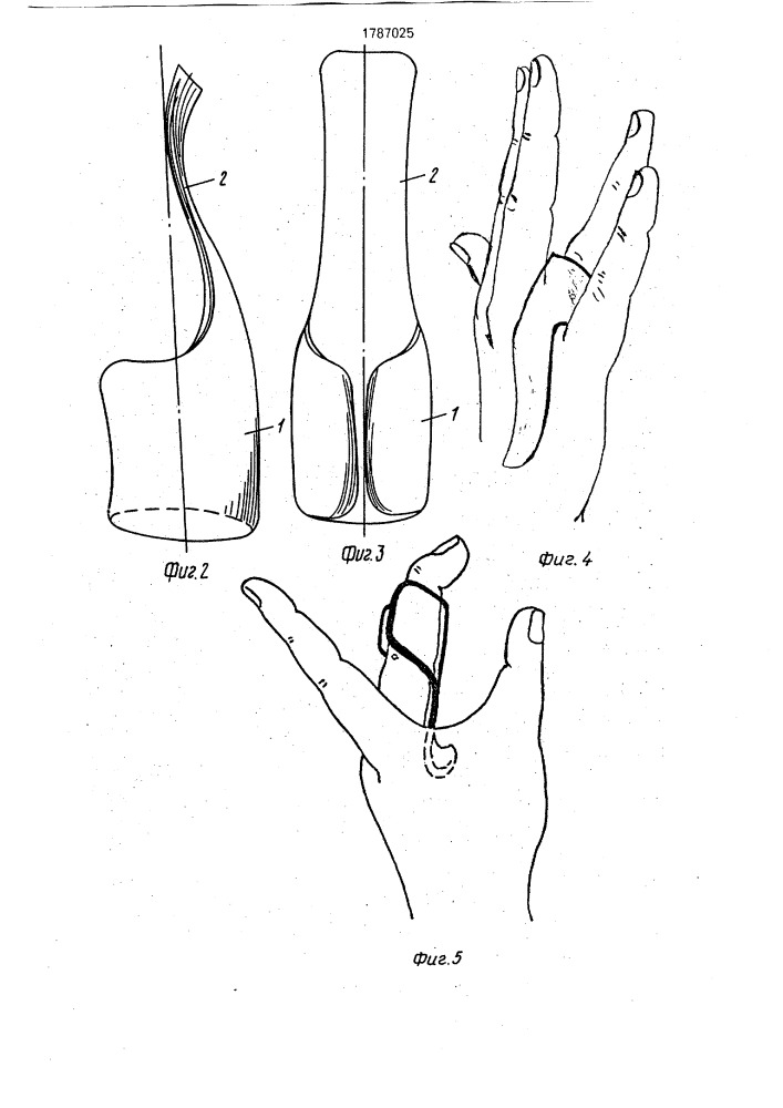 Ортез для пальца кисти (патент 1787025)