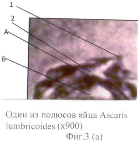 Способ прижизненной дифференциальной диагностики ascaris lumbricoides и ascaris suum по микроструктуре яиц (патент 2464561)