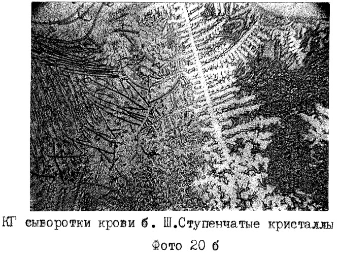 Способ экспресс-диагностики эндогенной интоксикации (патент 2280865)