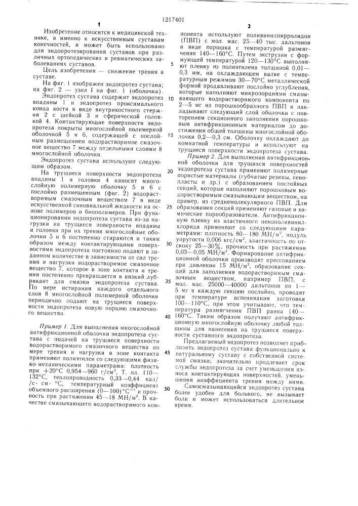 Эндопротез сустава системы в.в.василенкайтиса (патент 1217401)