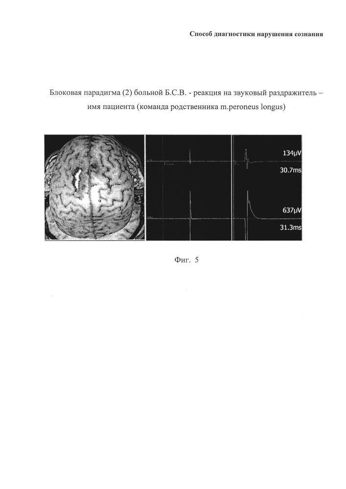 Способ диагностики нарушения сознания (патент 2596049)