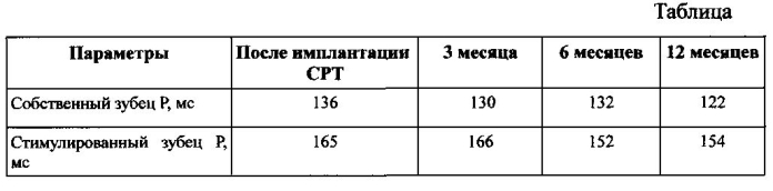 Способ оптимизации предсердно-желудочковой задержки у пациентов с сердечной ресинхронизирующей терапией (патент 2551636)