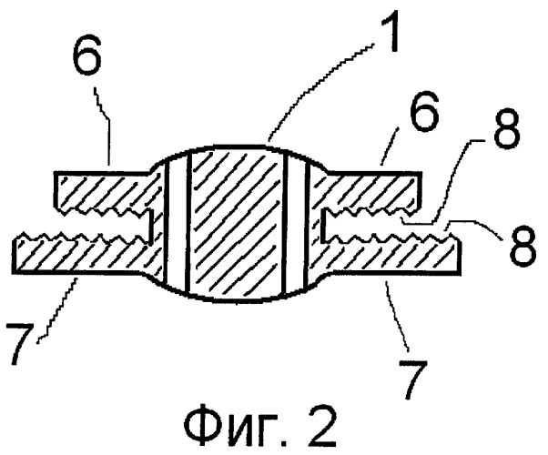 Интракапсулярный стабилизационно-оптический комплекс (патент 2421187)