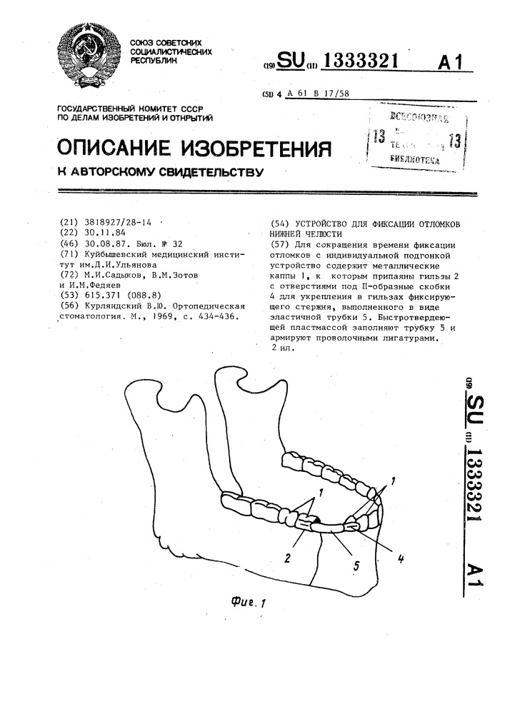 Устройство для фиксации отломков нижней челюсти (патент 1333321)