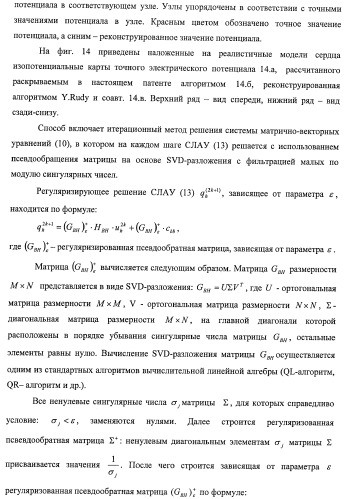 Способ неинвазивного электрофизиологического исследования сердца (патент 2417051)