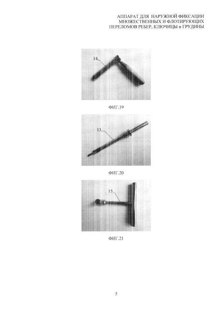 Аппарат для наружной фиксации множественных и флотирующих переломов ребер, ключицы и грудины (патент 2637834)