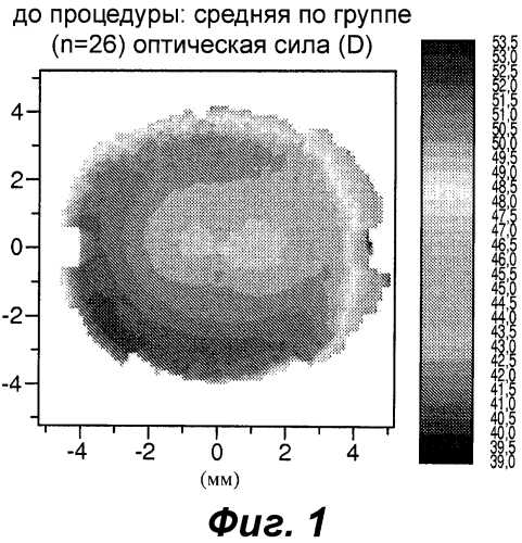 Конструкция офтальмологических линз для контроля близорукости (патент 2575048)