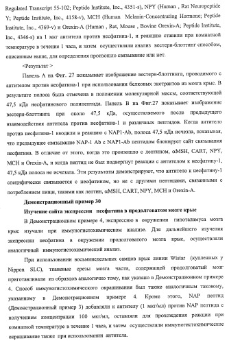 Способ получения фактора, связанного с контролем над потреблением пищи и/или массой тела, полипептид, обладающий активностью подавления потребления пищи и/или прибавления в весе, молекула нуклеиновой кислоты, кодирующая полипептид, способы и применение полипептида (патент 2418002)