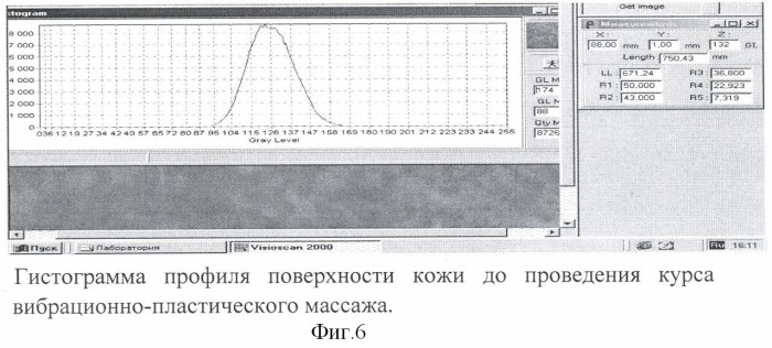 Способ коррекции инволюционных изменений кожи лица (патент 2379020)