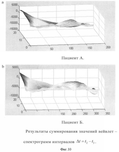 Способ выделения начала кардиоцикла (патент 2359606)