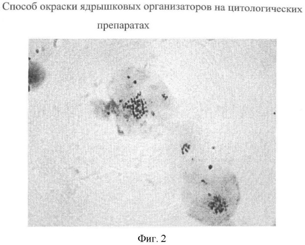 Способ окраски ядрышковых организаторов на гистологических препаратах и цитологических мазках (патент 2447438)