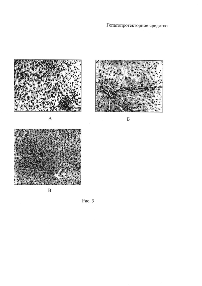 Гепатопротекторное средство (патент 2614691)