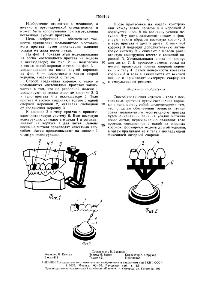 Способ соединения коронок и тела в мостовидных протезах (патент 1553102)