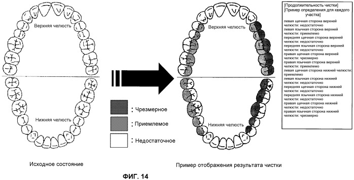 Электрическая зубная щетка (патент 2445938)