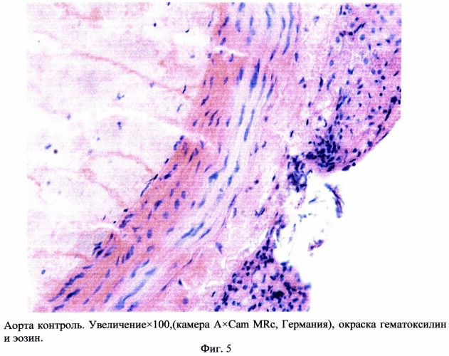 Способ моделирования атеросклероза (патент 2500041)