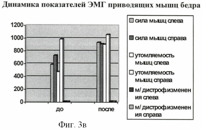 Способ лечения сочетанной деформации таза и позвоночника у детей (патент 2423095)
