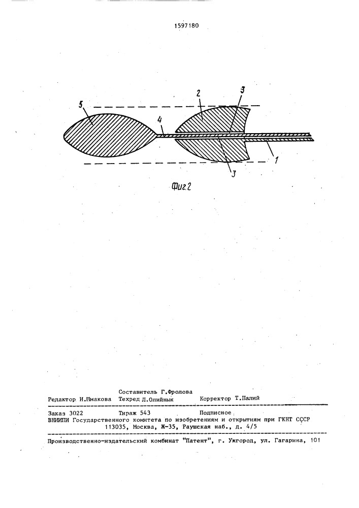 Зонд для тромбэктомии (патент 1597180)
