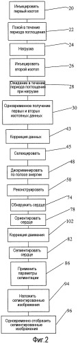 Сегментация сердца при формировании изображений сердца в покое и при нагрузке (патент 2531969)