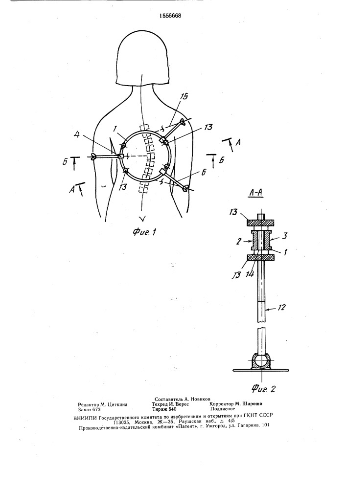 Устройство для лечения сколиоза (патент 1556668)