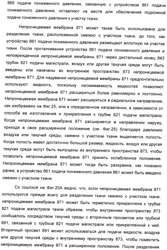 Способ лечения путем подкожной подачи пониженного давления с использованием разделения с помощью воздушного баллона (патент 2405588)