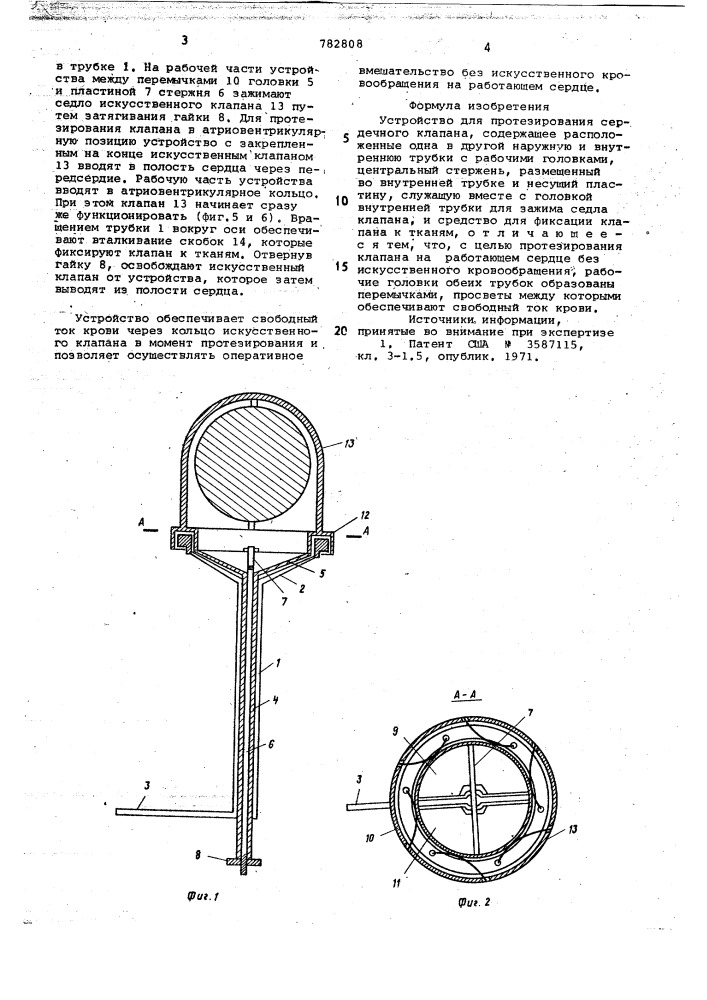 Устройство для протезирования сердечного клапана (патент 782808)