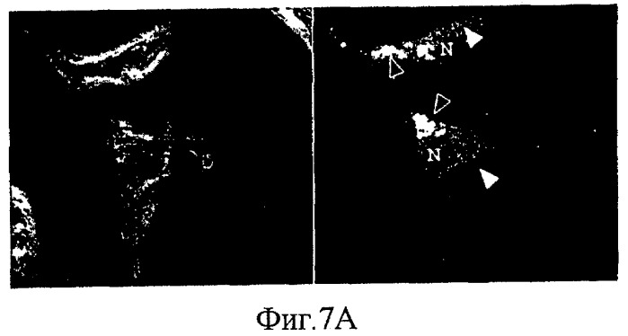 Получение биологически активных белков (патент 2441911)