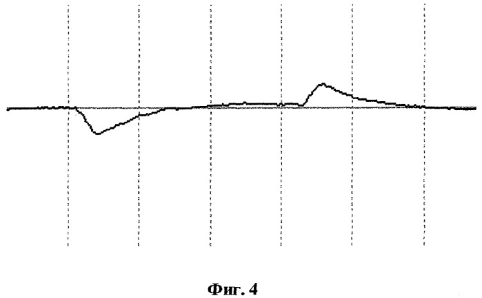 Способ определения траектории движений глаз при саккадических перемещениях взора (патент 2270598)