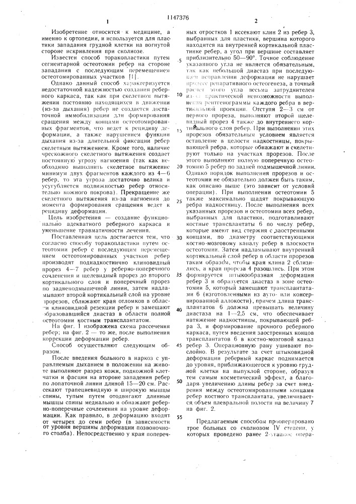 Способ торакопластики (патент 1147376)