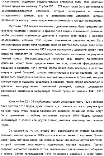 Устройство для лечения путем подкожной подачи пониженного давления с использованием текучей магистрали и связанный с ним способ (патент 2405459)