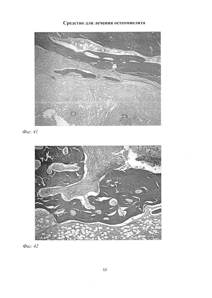 Средство для лечения остеомиелита (патент 2604124)