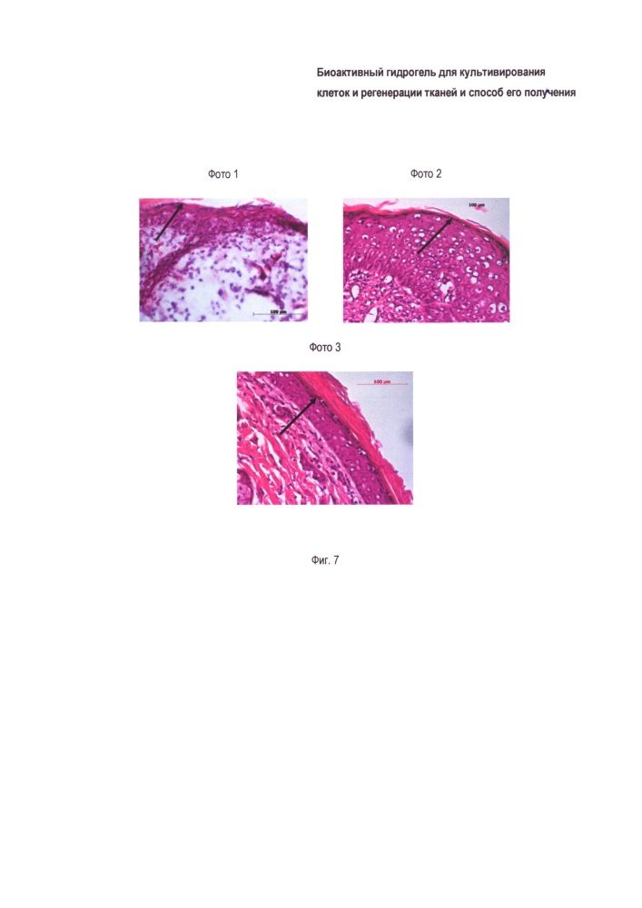 Биоактивный гидрогель для регенерации кожи (патент 2659383)