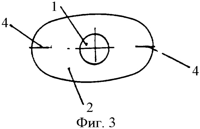 Искусственный хрусталик глаза (патент 2332962)