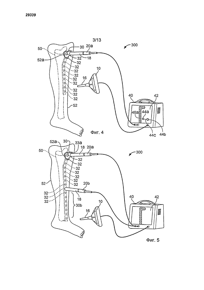 Нацеливание на опознавательные точки ортопедических устройств (патент 2627677)