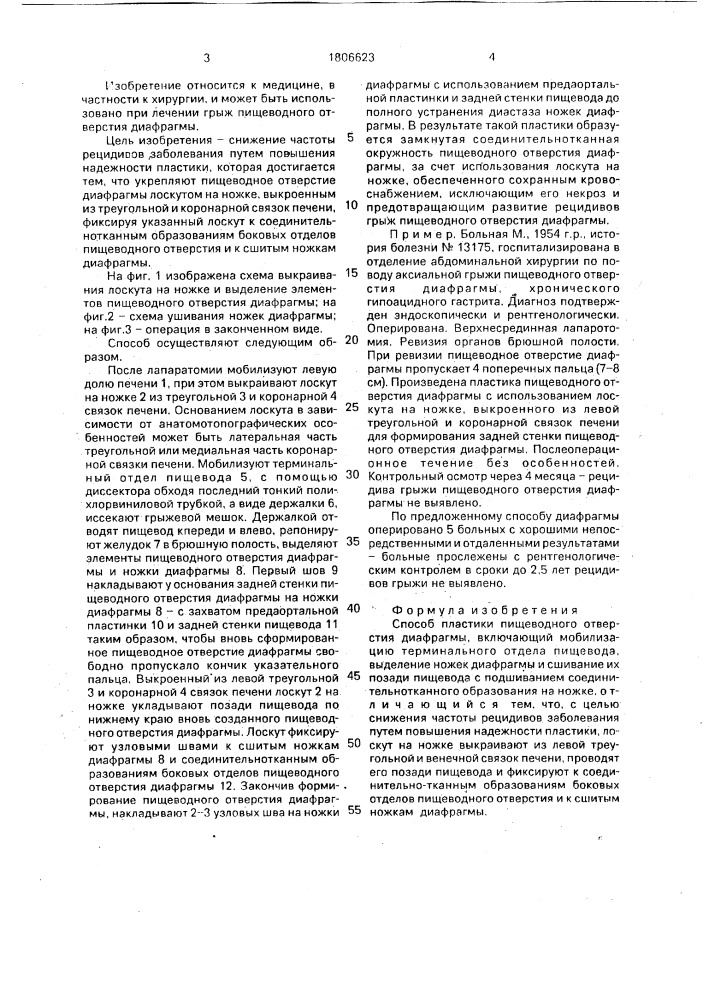 Способ пластики пищеводного отверстия диафрагмы (патент 1806623)