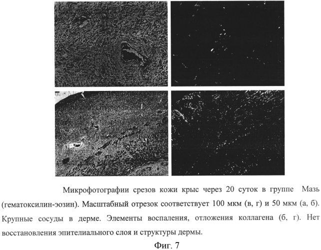 Средство для лечения ожогов и ран на основе цитокинов и факторов роста, секретируемых мезенхимными клетками человека, способ получения средства и способ лечения ожогов и ран (патент 2574017)