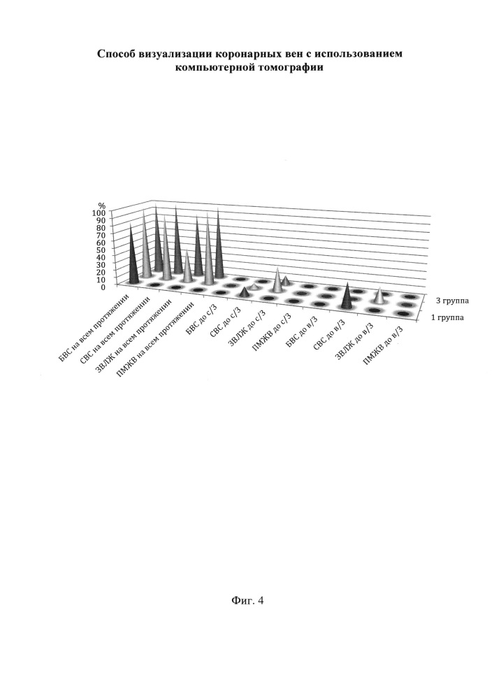Способ визуализации коронарных вен с использованием компьютерной томографии (патент 2648851)