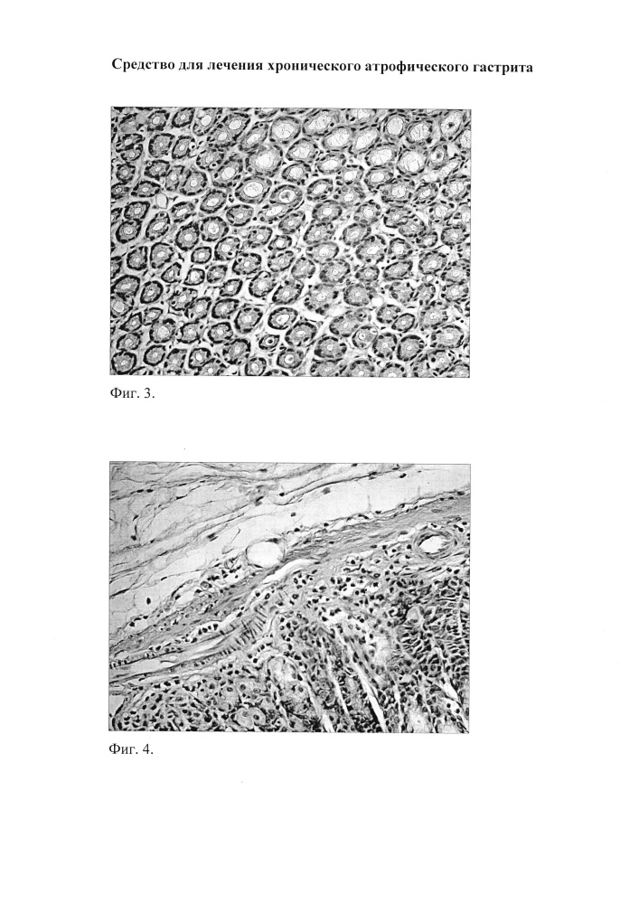 Средство для лечения хронического атрофического гастрита (патент 2623866)
