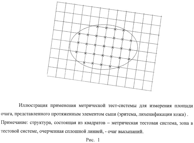 Способ оценки эффективности лечения атопического дерматита (патент 2445921)