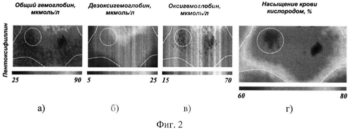 Способ неинвазивного определения кислородного статуса тканей (патент 2498767)