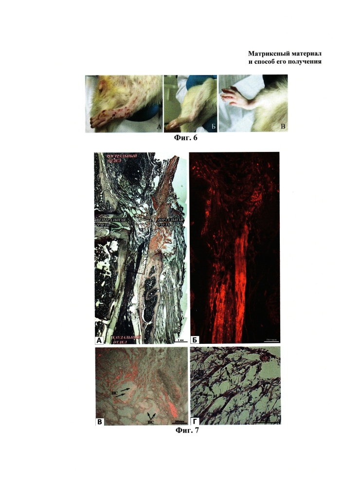 Имплантируемый матриксный материал для регенеративной медицины и способ его получения (варианты) (патент 2597085)