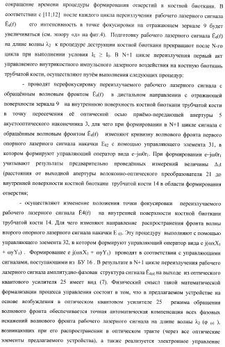 Способ дистального блокирования интрамедуллярных стержней при остеосинтезе длинных трубчатых костей и устройство для его осуществления (патент 2387401)