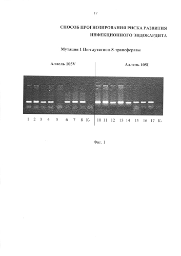 Способ прогнозирования риска развития инфекционного эндокардита (патент 2587753)