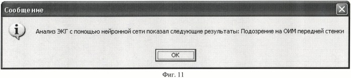 Способ нейросетевого анализа состояния сердца (патент 2461877)