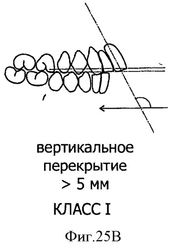Зубные протезы, зубные дуги и способы их изготовления (патент 2510252)