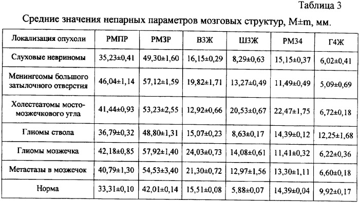 Способ диагностики опухолей задней черепной ямки (патент 2338466)