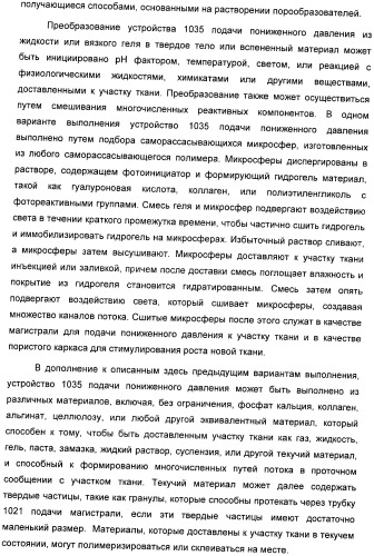 Система и способ продувки устройства пониженного давления во время лечения путем подачи пониженного давления (патент 2404822)