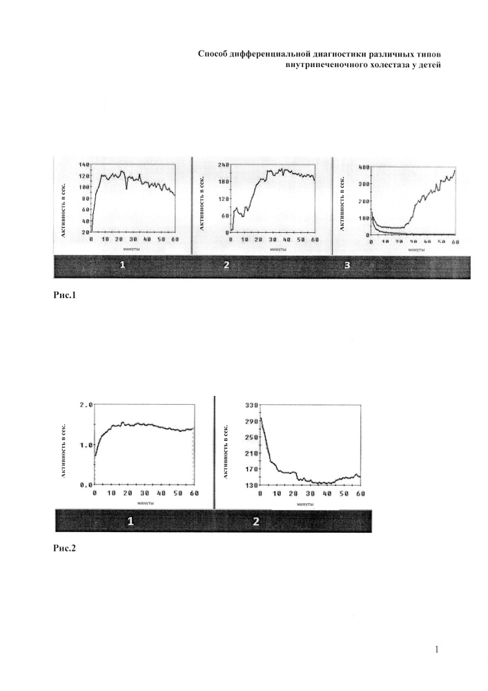 Способ дифференциальной диагностики различных типов внутрипеченочного холестаза у детей (патент 2615358)