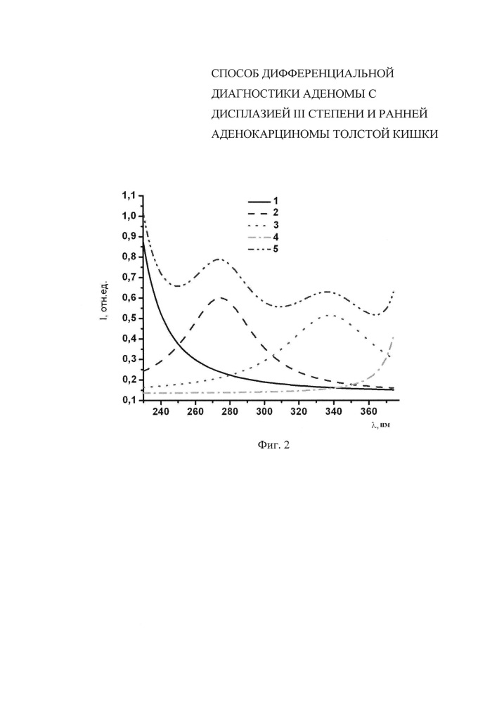 Способ дифференциальной диагностики аденомы с дисплазией iii степени и ранней аденокарциномы толстой кишки (патент 2638805)